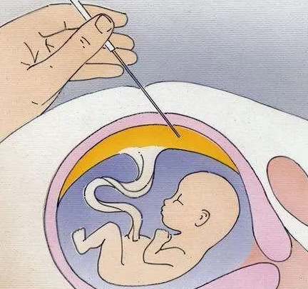 长沙专业供卵代怀-坤和代怀孕产子服务